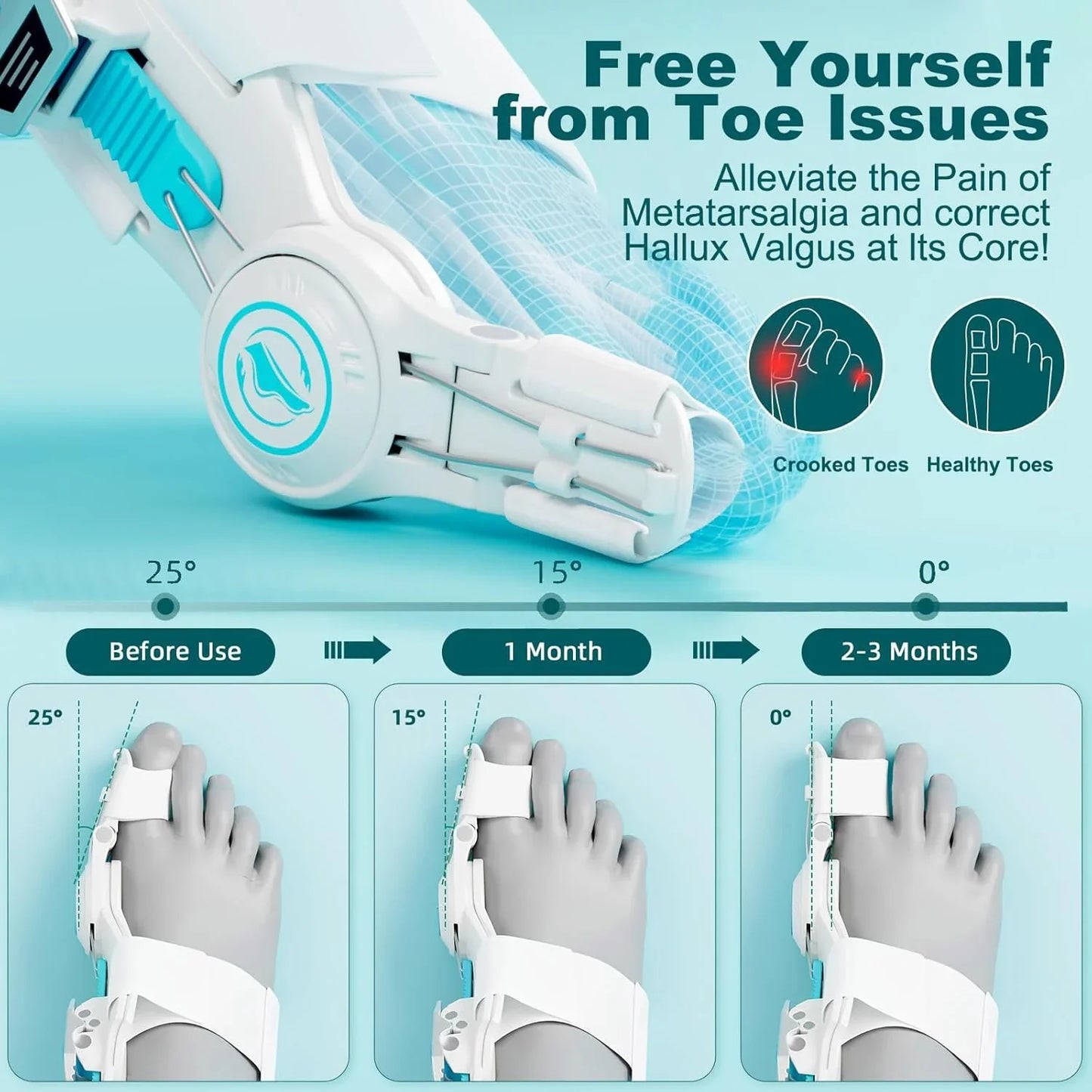 Upgraded Bunion Corrector for Women Men, Orthopedic Bunions Correction with Non Slip Big Toe Straighteners, Adjustable Bunion Splint Suitable for Day/Night Feet Bunion Relief (2PCS)